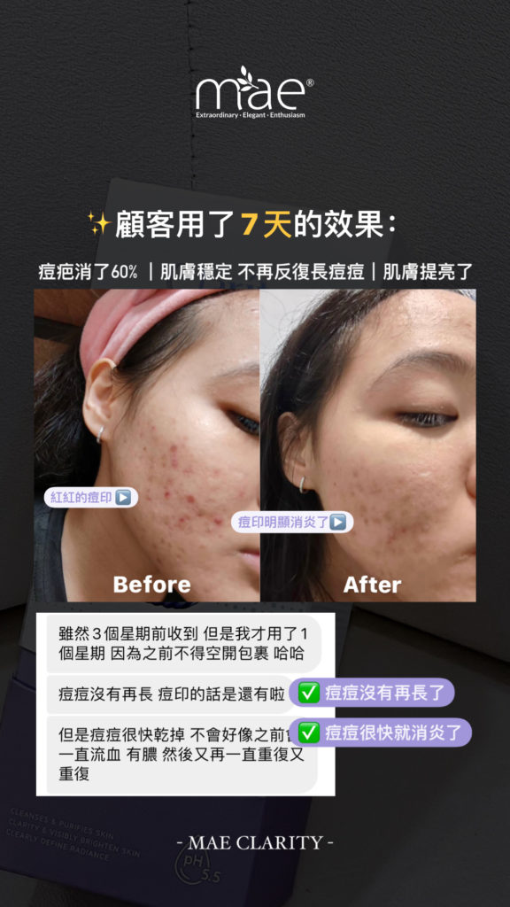 mae clarity ,mae香港,MAE skincare series ,天然護膚品,深層清潔,暗瘡皮膚,痘敏肌,毛孔粗大,黑頭粉刺