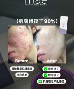 MAE clarity, mask ,skincare series,暗瘡產品,深層清潔,去角質