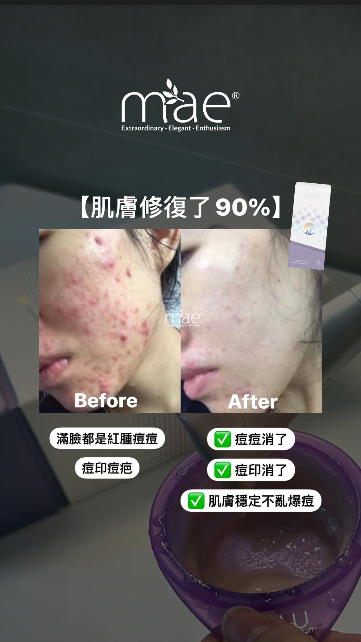 MAE clarity, mask ,skincare series,暗瘡產品,深層清潔,去角質 MAE clarity, mask ,skincare series,暗瘡產品,深層清潔,去角質
