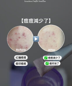 MAE clarity, mask ,skincare series,暗瘡產品,深層清潔,去角質