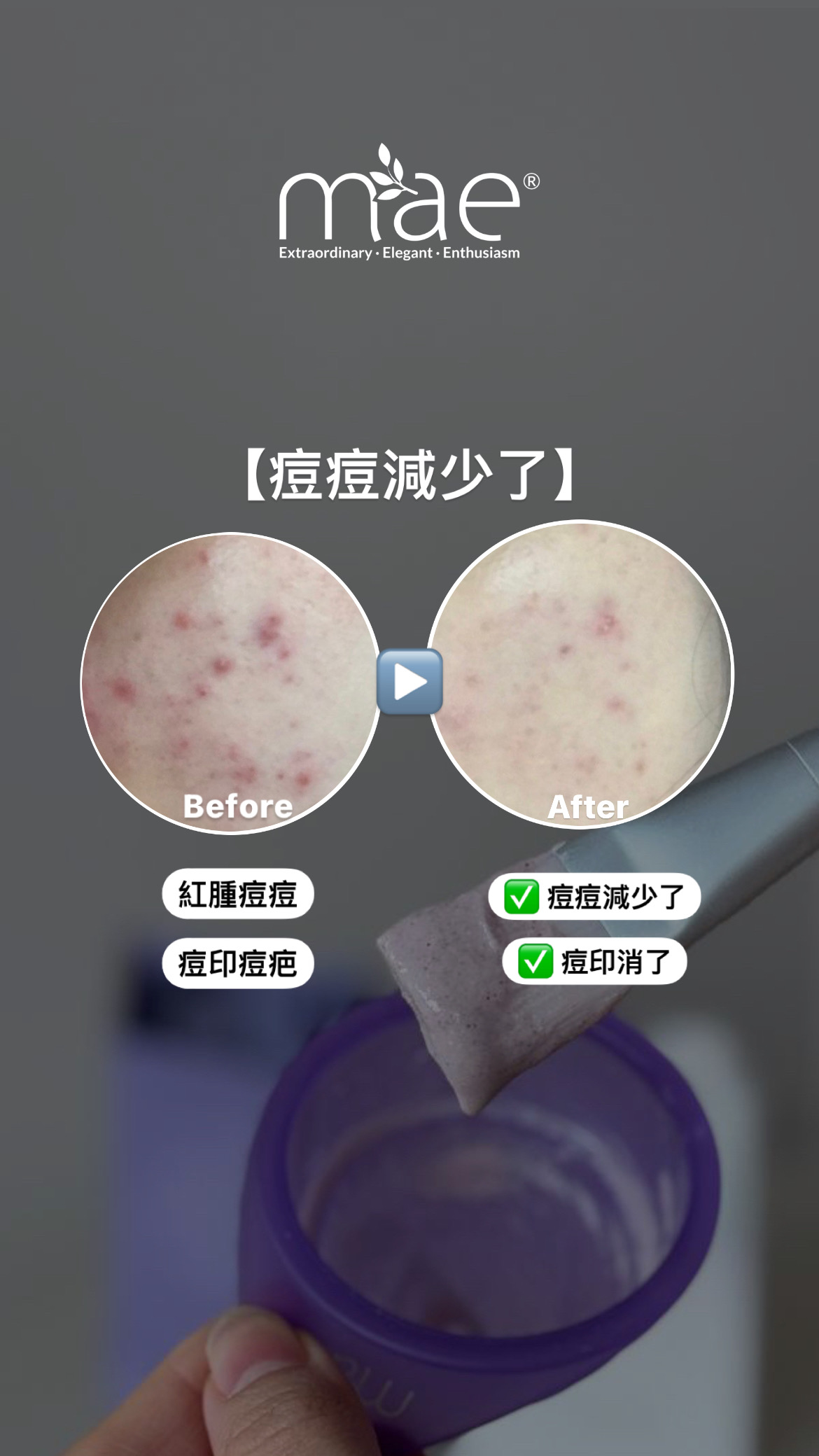 MAE clarity, mask ,skincare series,暗瘡產品,深層清潔,去角質 MAE clarity, mask ,skincare series,暗瘡產品,深層清潔,去角質
