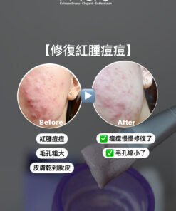 MAE clarity, mask ,skincare series,暗瘡產品,深層清潔,去角質