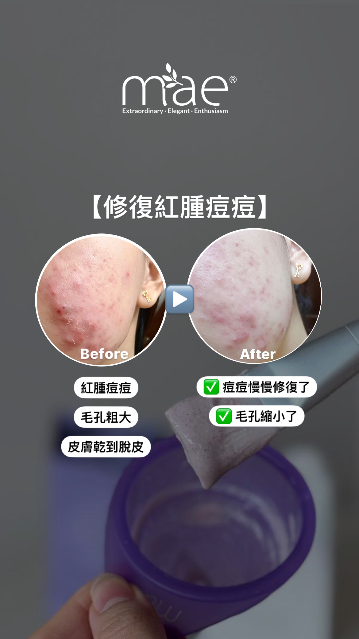 MAE clarity, mask ,skincare series,暗瘡產品,深層清潔,去角質 MAE clarity, mask ,skincare series,暗瘡產品,深層清潔,去角質