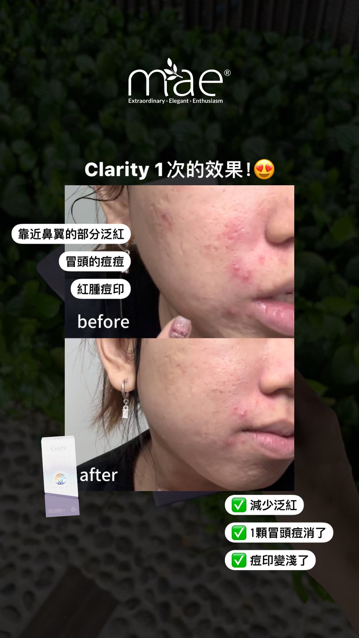 MAE clarity, mask ,skincare series,暗瘡產品,深層清潔,去角質 MAE clarity, mask ,skincare series,暗瘡產品,深層清潔,去角質