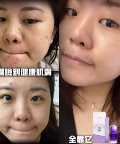 MAE clarity, mask ,skincare series,暗瘡產品,深層清潔,去角質,MAEHK,MAE香港