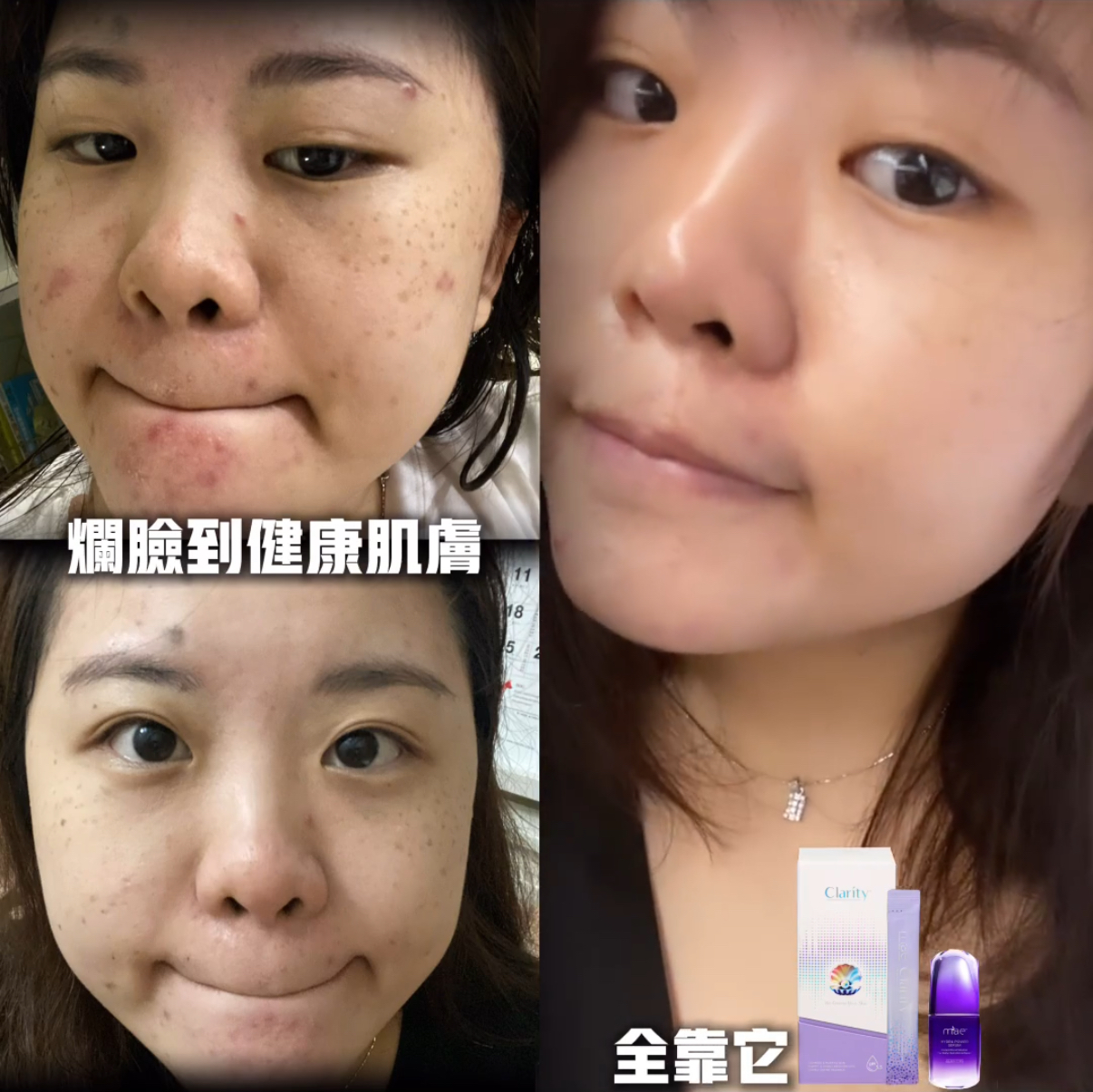 MAE clarity, mask ,skincare series,暗瘡產品,深層清潔,去角質,MAEHK,MAE香港 MAE clarity, mask ,skincare series,暗瘡產品,深層清潔,去角質,MAEHK,MAE香港